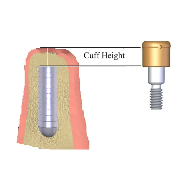 CUFF/TISSUE HEIGHT 1